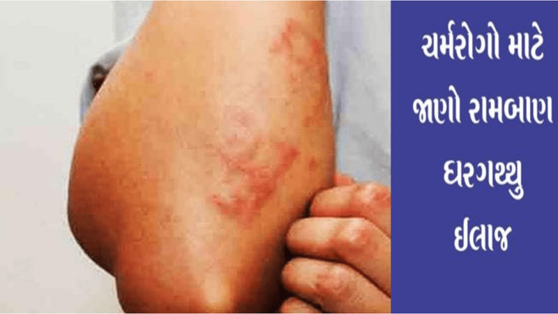 skin problems in monsoon: ચોમાસામાં કેમ વધે છે ચામડીના રોગો? જાણો કારણો અને સચોટ ઉપચાર